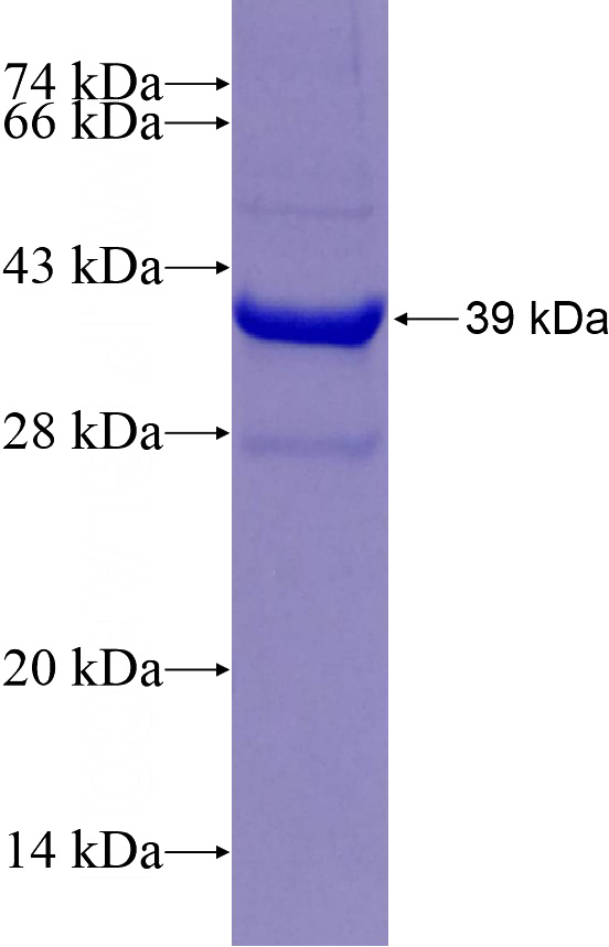 Recombinant Human GAS2 SDS-PAGE