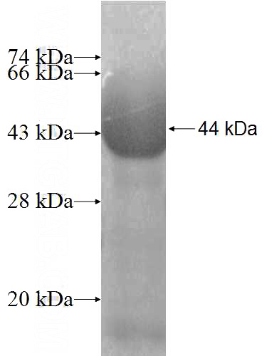 Recombinant Human UBQLNL SDS-PAGE