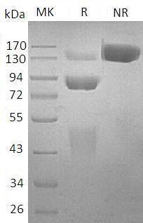Human MET (His tag) recombinant protein