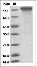 Human IL6ST / gp130 / CD130 Protein (Fc Tag)