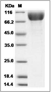 Rat PDGFRa / CD140a Protein (His Tag) SDS-PAGE
