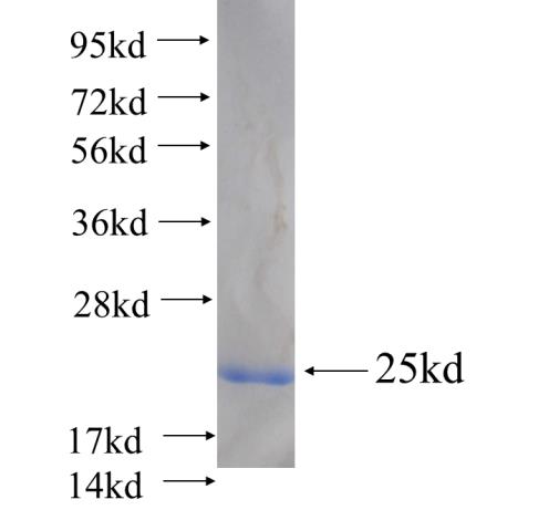 Recombinant human NAT13(Full length) SDS-PAGE