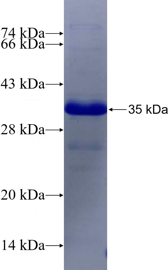 Recombinant Human Dendrin SDS-PAGE