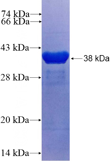 Recombinant Human LSM3 SDS-PAGE