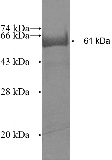 Recombinant Human GIMAP7 SDS-PAGE