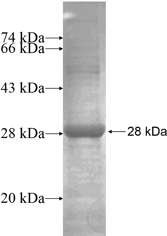 Recombinant Human ITIH1 SDS-PAGE