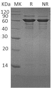 Human BLNK/BASH/SLP65 (His tag) recombinant protein