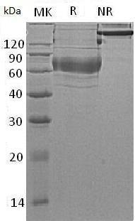 Human IZUMO4/C19orf36/UNQ831/PRO1758 (Fc tag) recombinant protein