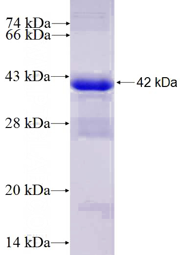 Recombinant Human DUSP12 SDS-PAGE