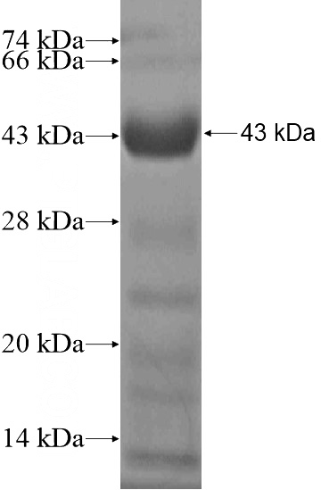 Recombinant Human ANKRD34B SDS-PAGE