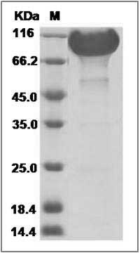 Human KIRREL / NEPH1 / KIRREL1 Protein (Fc Tag) SDS-PAGE