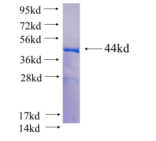 Recombinant human UBE4B SDS-PAGE