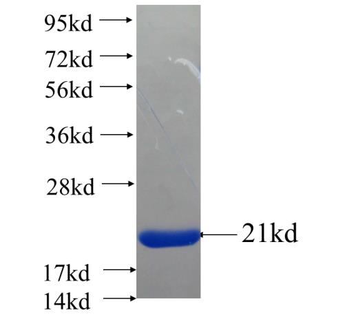 Recombinant human SLC25A29 SDS-PAGE