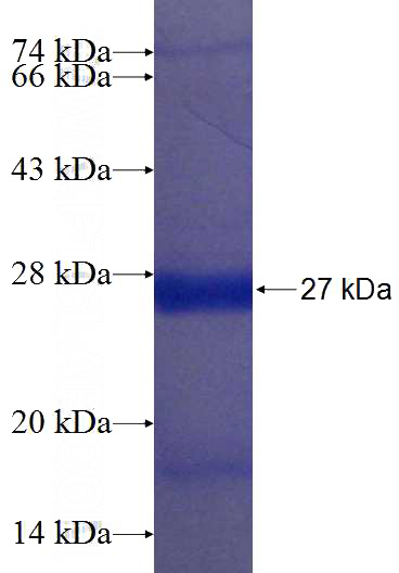 Recombinant Human FREQ SDS-PAGE