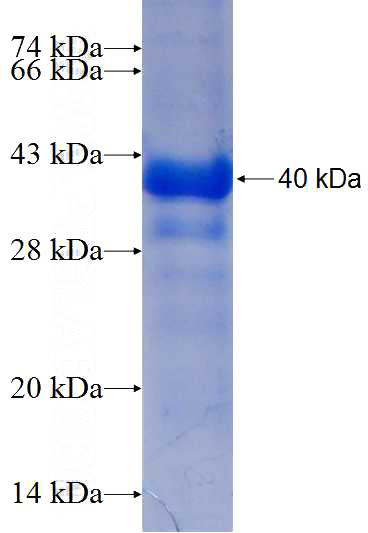 Recombinant Human H2AFJ SDS-PAGE