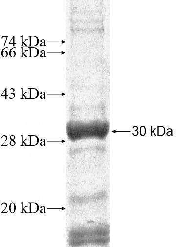 Recombinant Human PDLIM7 SDS-PAGE