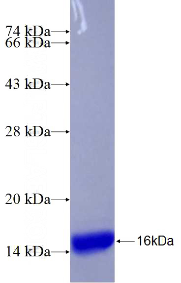 Recombinant Human AADAC SDS-PAGE
