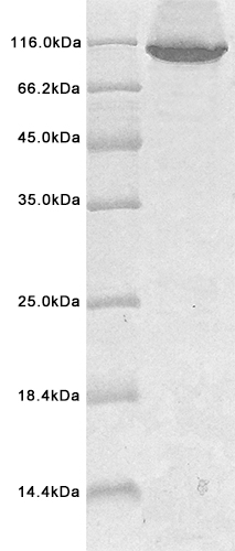 Human E3 ubiquitin-protein ligase UHRF1