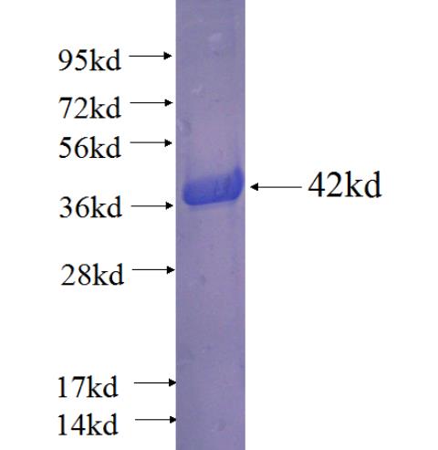 Recombinant human UBXN11 SDS-PAGE