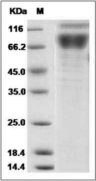 Mouse IL17RA / IL17R / CD217 Protein (Fc Tag) SDS-PAGE
