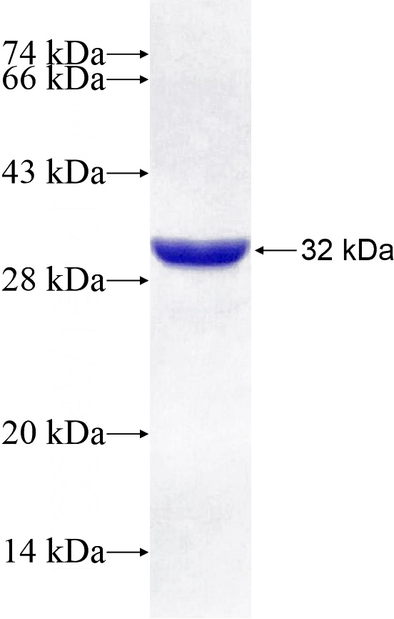 Recombinant Human USP53 SDS-PAGE
