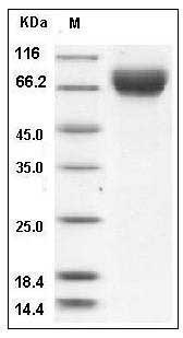 Rat E-Selectin / CD62e / SELE Protein (His Tag) SDS-PAGE
