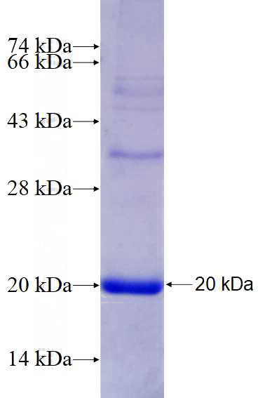 Recombinant Human SRD5A1 SDS-PAGE