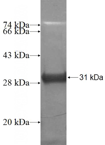Recombinant Human RTP1 SDS-PAGE
