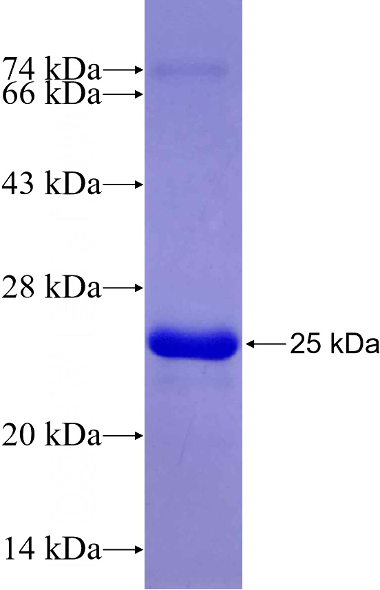 Recombinant Human ADIPOR2 SDS-PAGE