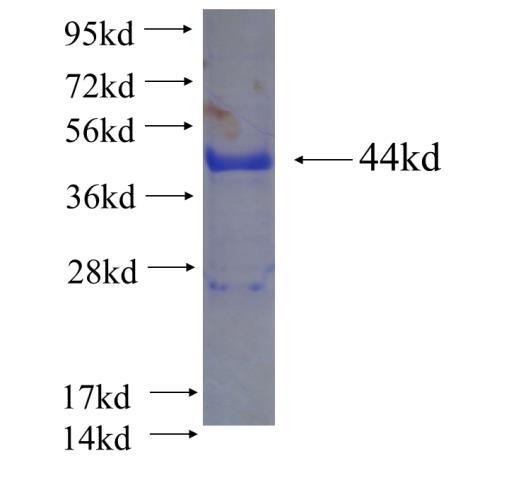 Recombinant human F2 SDS-PAGE
