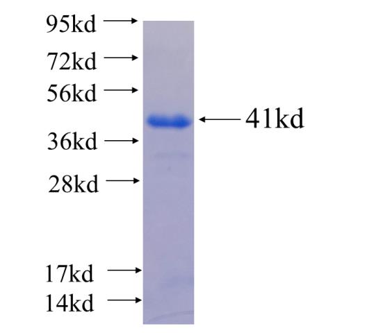 Recombinant human ATP2C1 SDS-PAGE