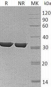 Human ANXA3/ANX3 recombinant protein