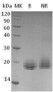 Human LAIR2/CD306 (His tag) recombinant protein