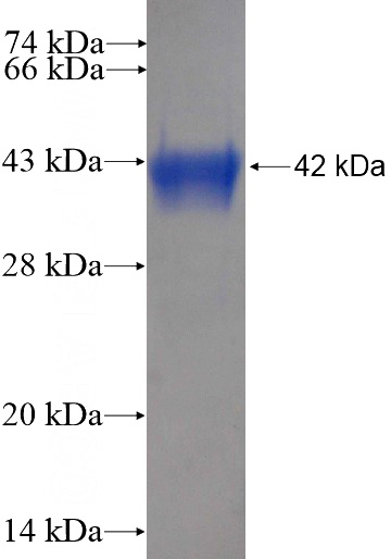 Recombinant Human SH3BP1 SDS-PAGE