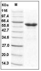 Human tPA / PLAT Protein (Fc Tag) SDS-PAGE