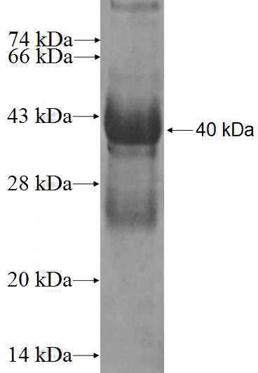 Recombinant Human SLC30A4 SDS-PAGE