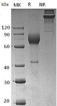 Mouse Il2ra/Il2r (Fc tag) recombinant protein