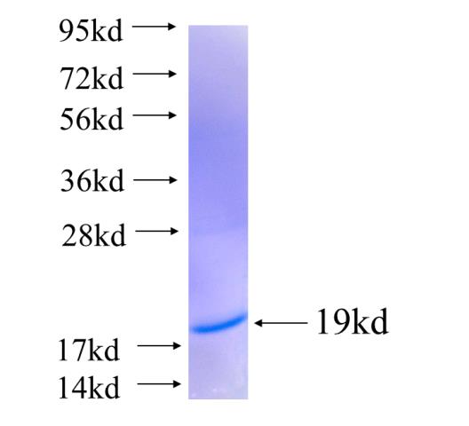 Recombinant human S100A5(Full length) SDS-PAGE