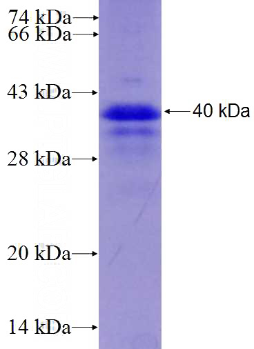 Recombinant Human PIAS3 SDS-PAGE