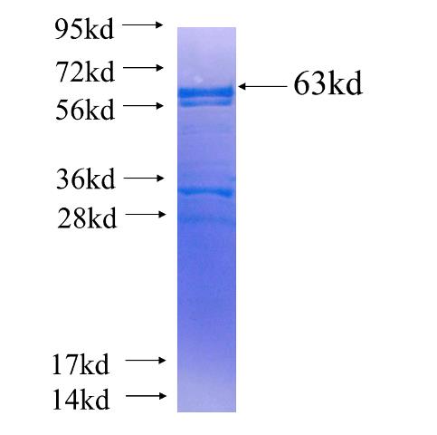 Recombinant human ACBD5 SDS-PAGE