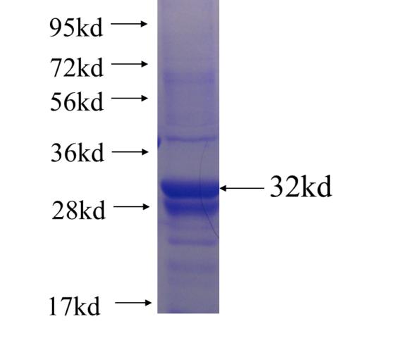 Recombinant human HDC SDS-PAGE