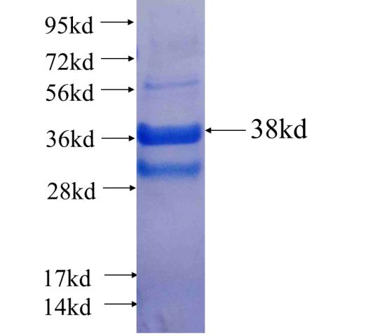 Recombinant human KLRF1 SDS-PAGE