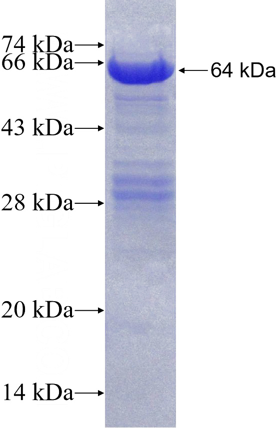 Recombinant Human Ataxin 2 SDS-PAGE