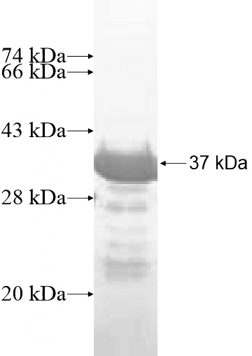 Recombinant Human RING1 SDS-PAGE