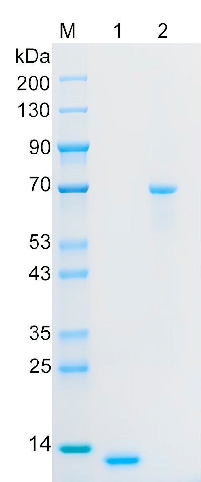 Recombinant S10AE protein (His tag) SDS-PAGE