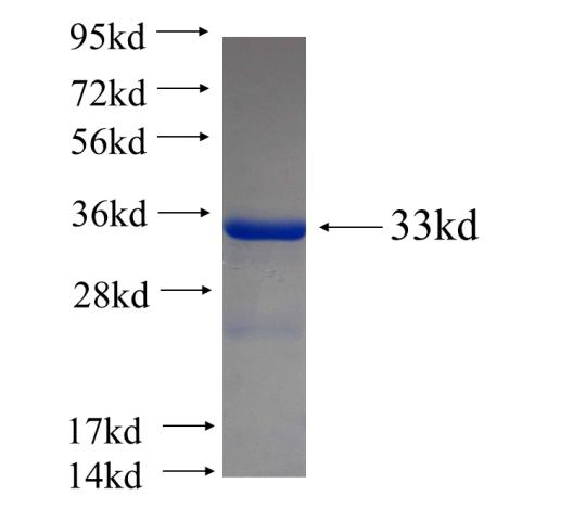 Recombinant human KCTD15 SDS-PAGE