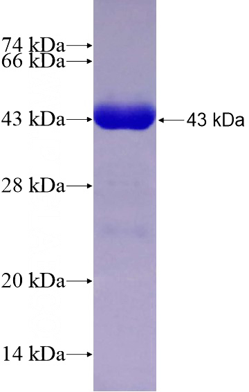 Recombinant Human SRGAP3 SDS-PAGE