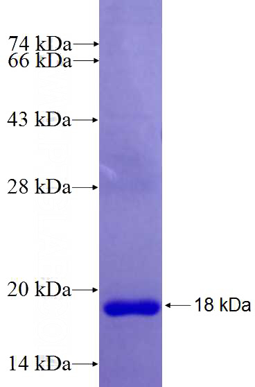 Recombinant Human ZFX SDS-PAGE