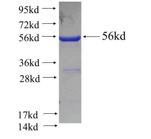 Recombinant human PROSC SDS-PAGE
