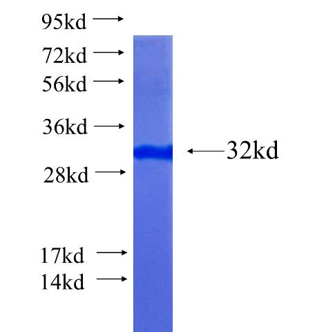 Recombinant human LTBP1 SDS-PAGE